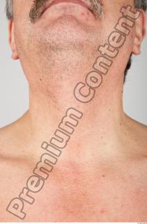 Neck 3D scan texture 0001